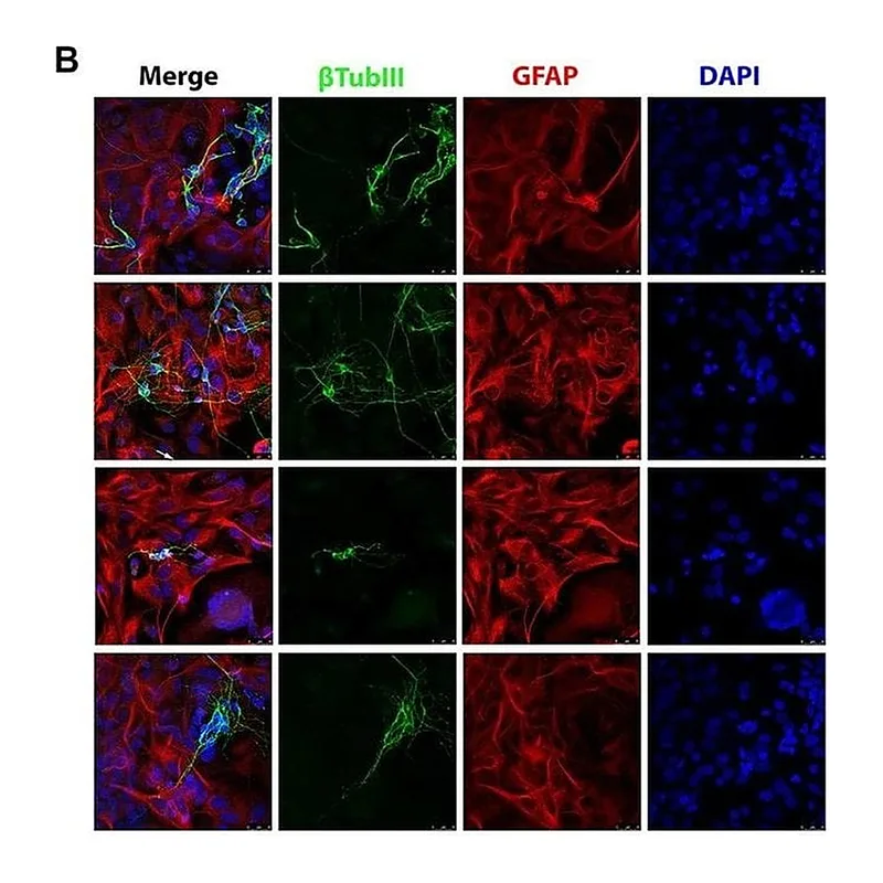 Thermo Fisher Scientific Goat anti-Rat IgG (H+L) Cross-Adsorbed Secondary Antibody, Alexa Fluor 555