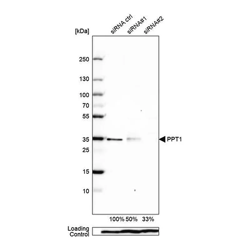 Merck Anti-PPT1 antibody produced in rabbit