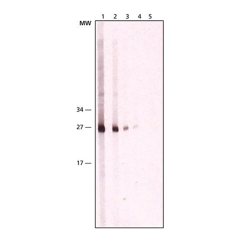 Merck Monoclonal Anti-Cathepsin K antibody produced in mouse