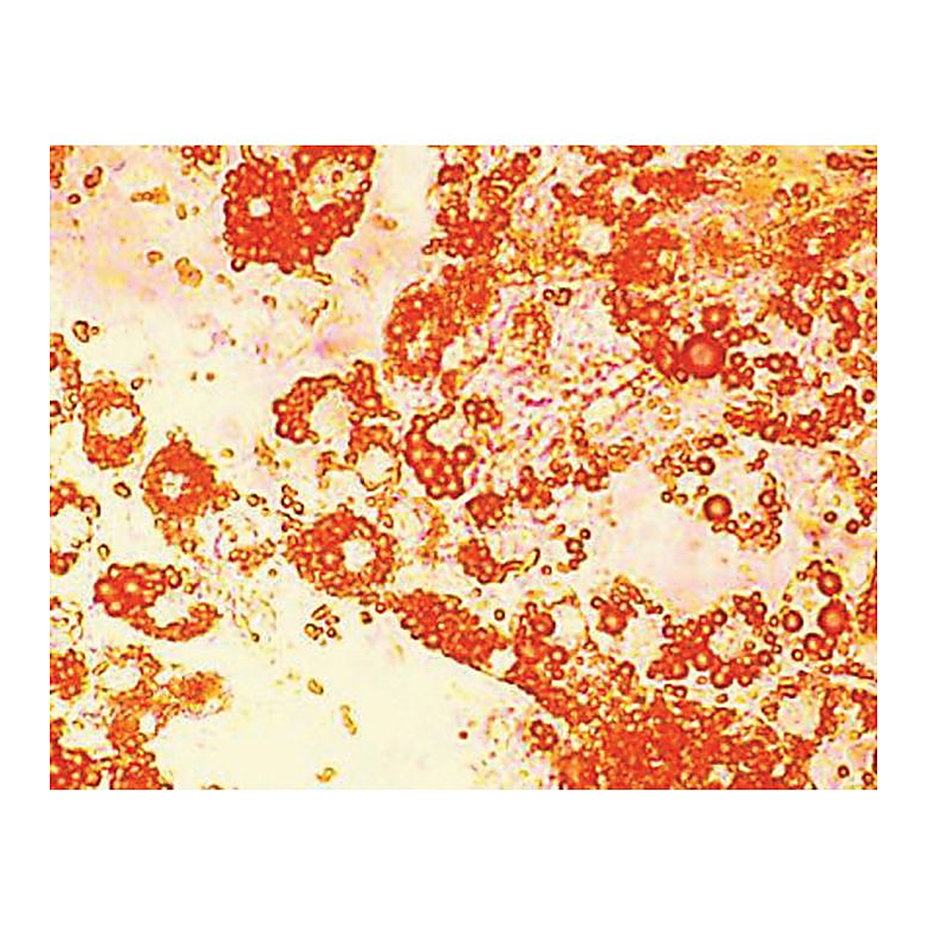 Himedia HiDiff Adipogenesis Assay Kit