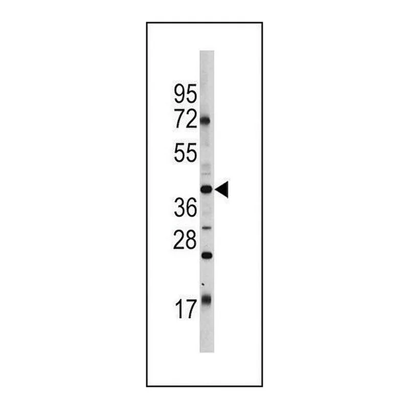 Merck ANTI-OCT4 (OCT3) (E125) antibody produced in rabbit