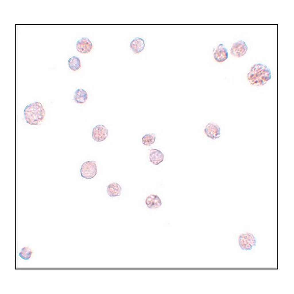 Merck Anti-ATP11A antibody produced in rabbit