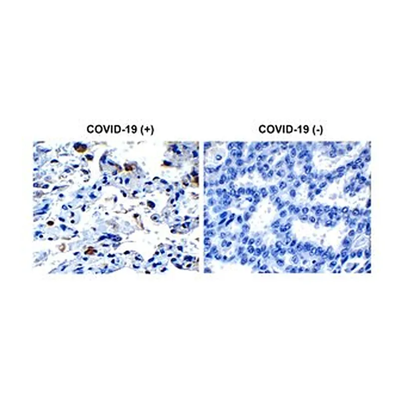 Merck Anti-SARS-CoV-2 (COVID-19) Envelope ant&