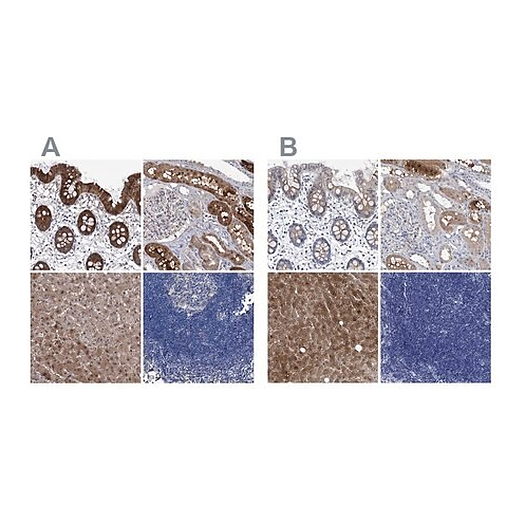 Merck Anti-GPT antibody produced in rabbit