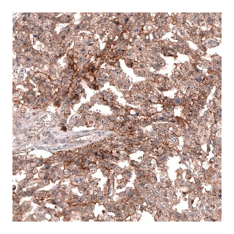 Merck Anti-TNFRSF8 antibody produced in mouse