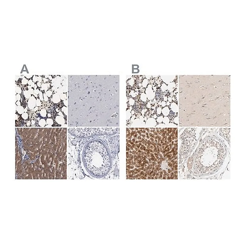 Merck Anti-PYGL antibody produced in rabbit