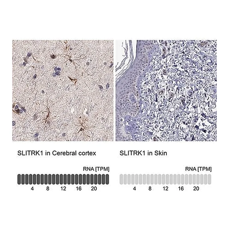 Merck Anti-SLITRK1 antibody produced in rabbit