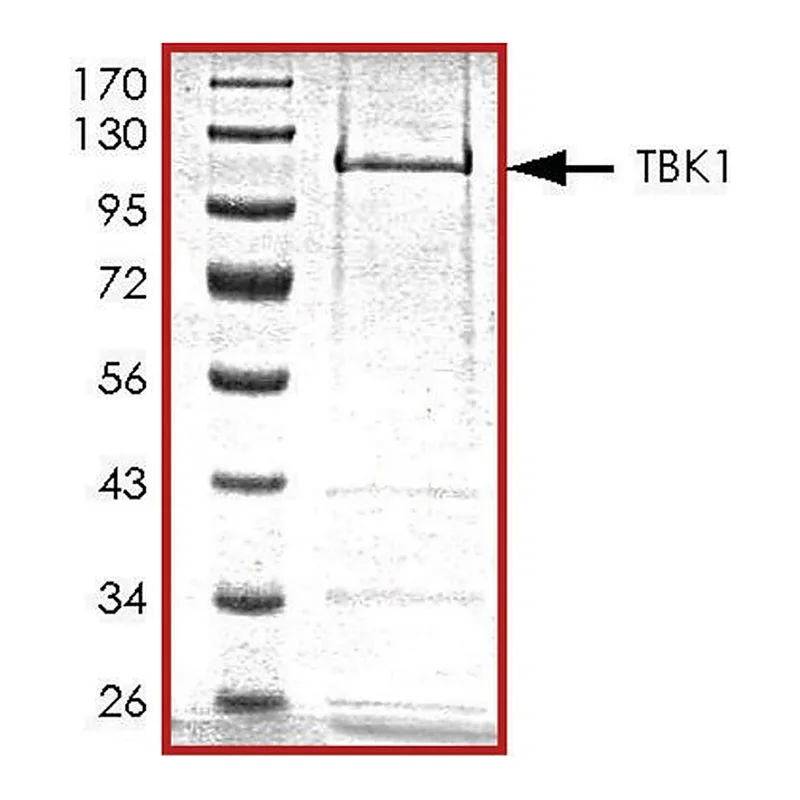 Merck TBK1, active, GST tagged human