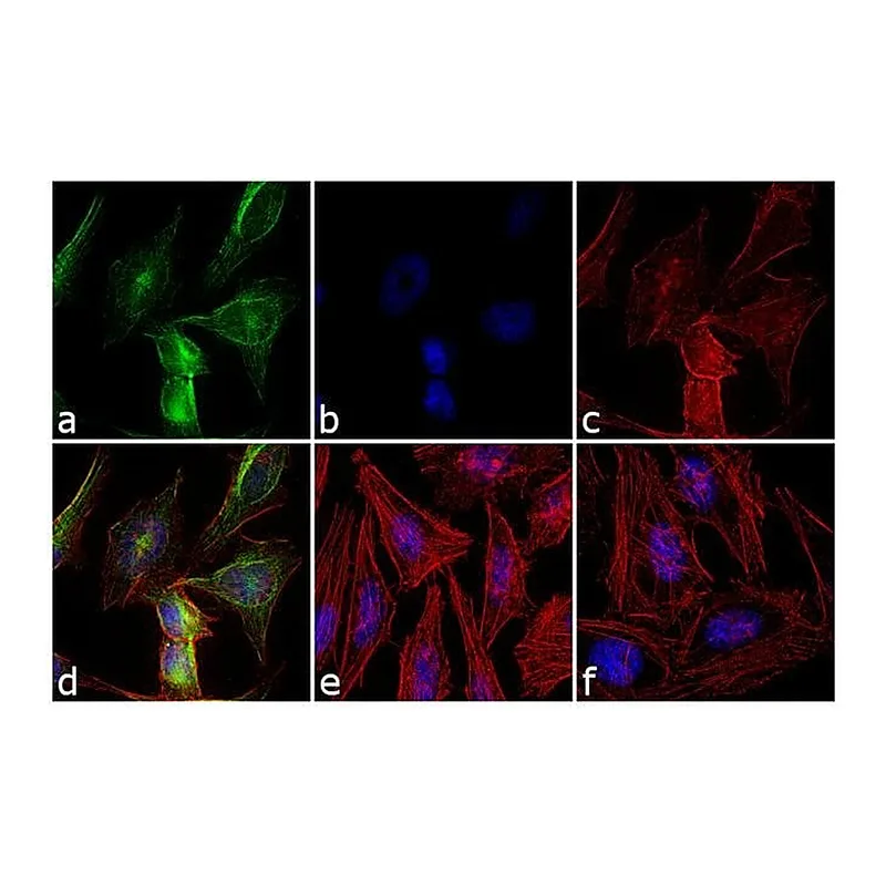 Thermo Fisher Scientific Goat anti-Rabbit IgG (H+L) Secondary Antibody, FITC