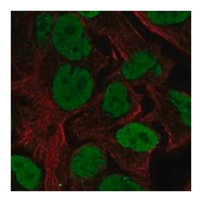 Merck Anti-FOXK2 antibody produced in rabbit