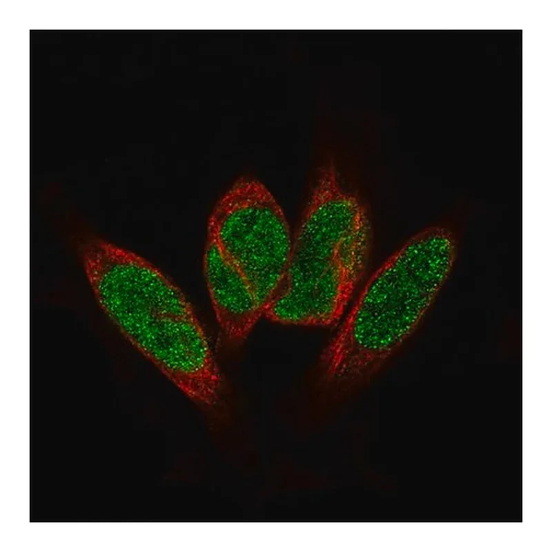 Merck Monoclonal Anti-GLI1 antibody produced in mouse