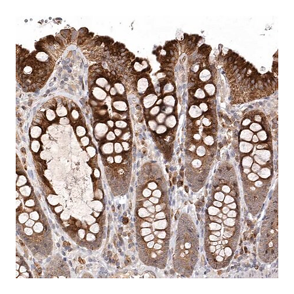 Merck Anti-KIF2B antibody produced in rabbit