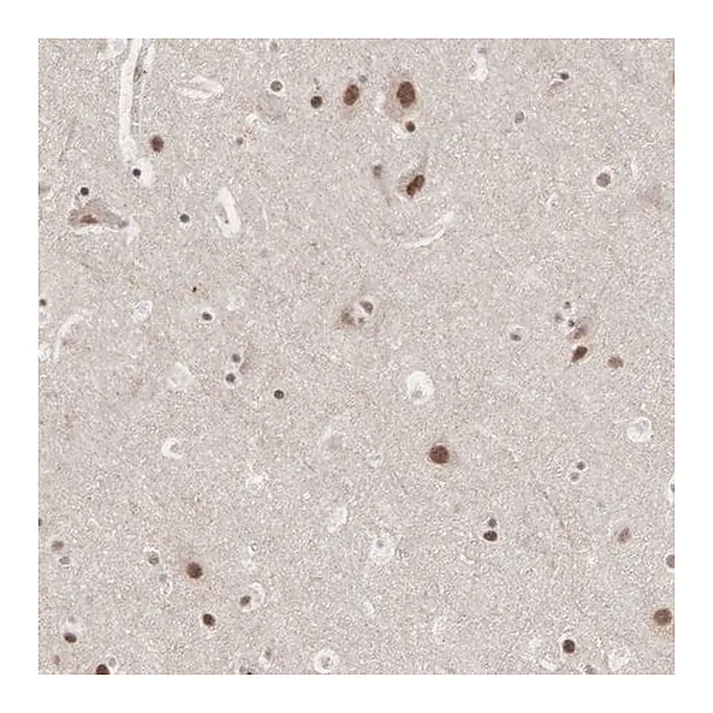 Merck Anti-AUTS2 antibody produced in rabbit