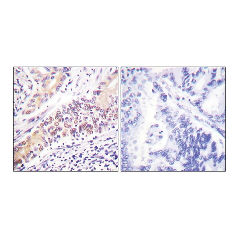 Merck Anti-TOP2B antibody produced in rabbit
