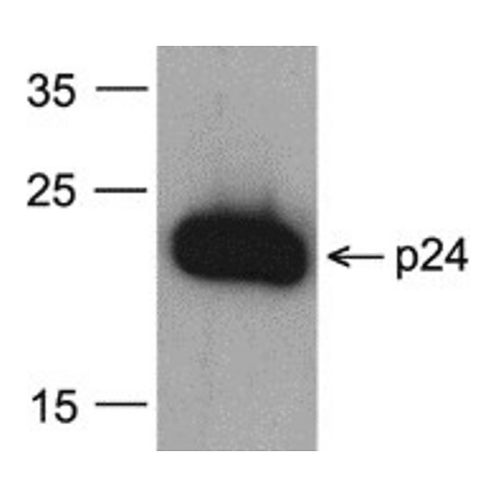 Merck Monoclonal Anti-HIV-1 p24 [8G9] (biotin) antibody produced in mouse