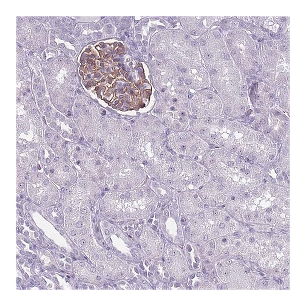 Merck Anti-ROS1 antibody produced in rabbit