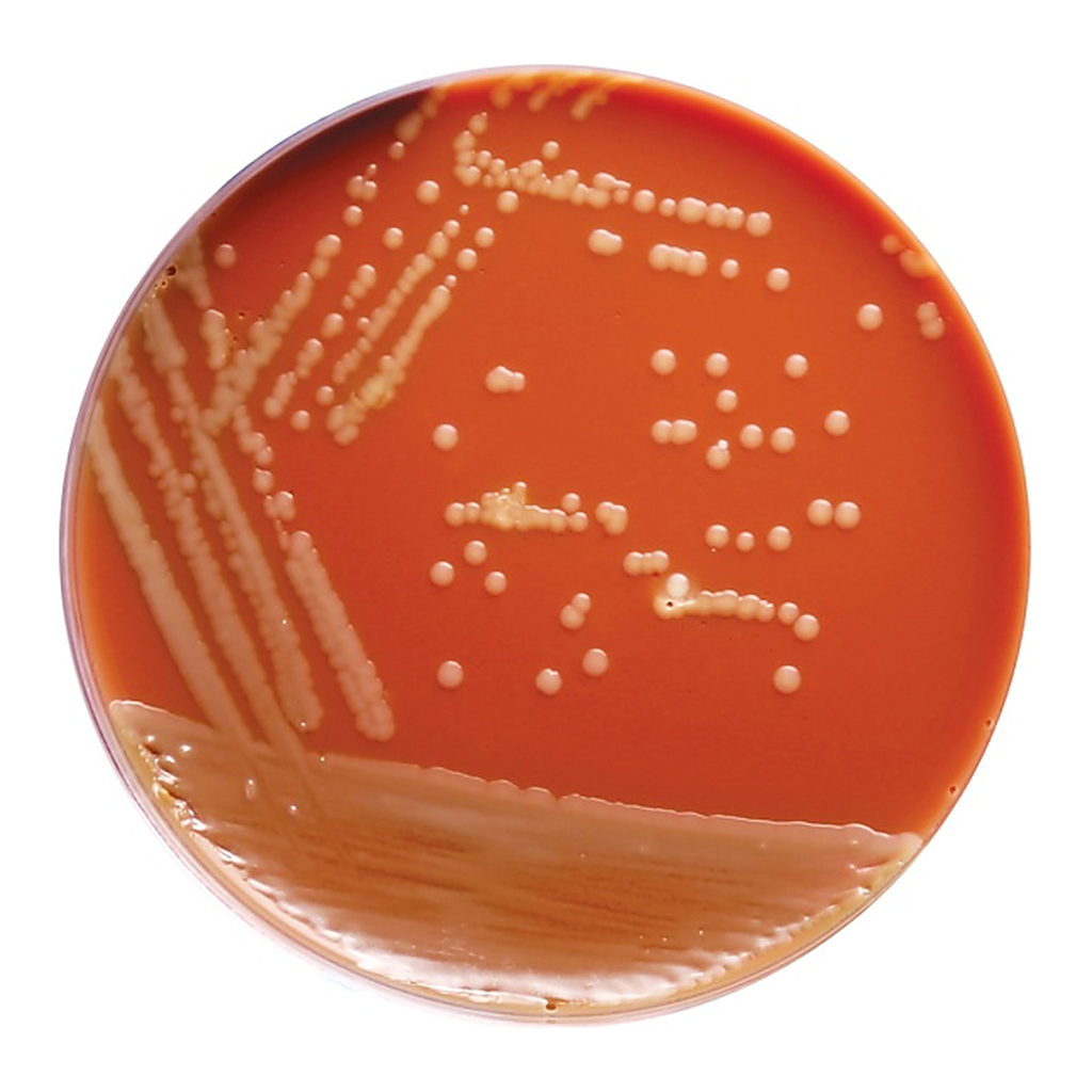 Himedia GC Agar Base