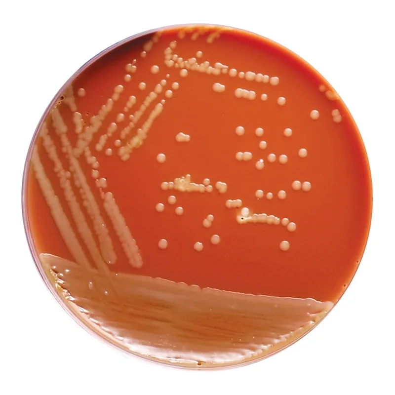 Himedia GC Agar Base