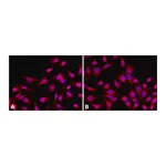 Merck Anti-Histone Deacetylase 4 (HDAC4) antibody, Mouse monoclonal