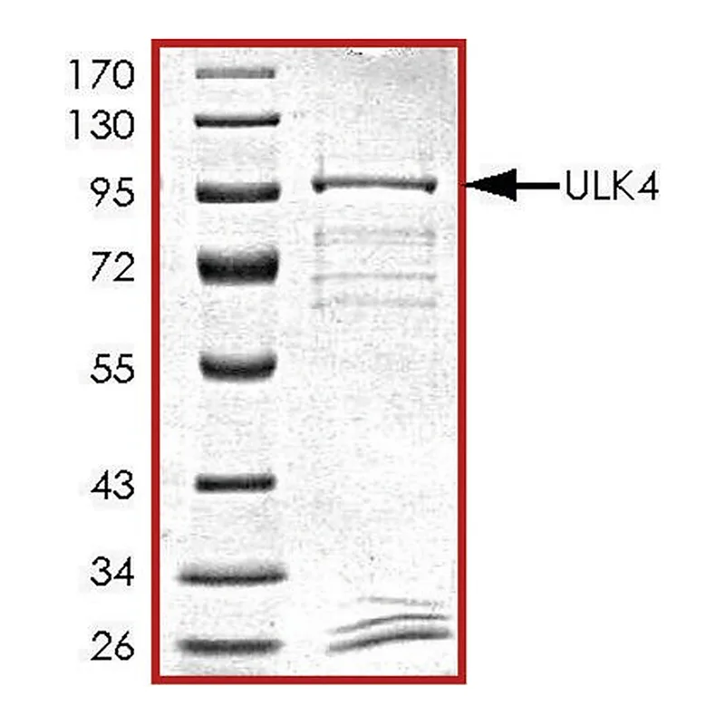 Merck ULK4, GST tagged human