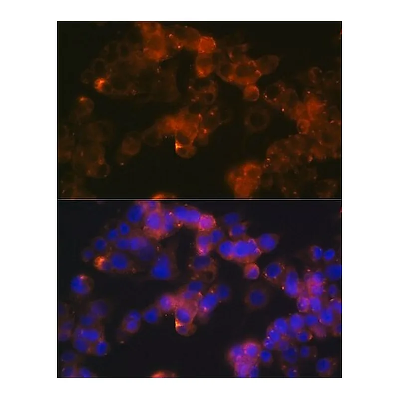 Merck Anti-Sonic Hedgehog (Shh) antibody produced in rabbit