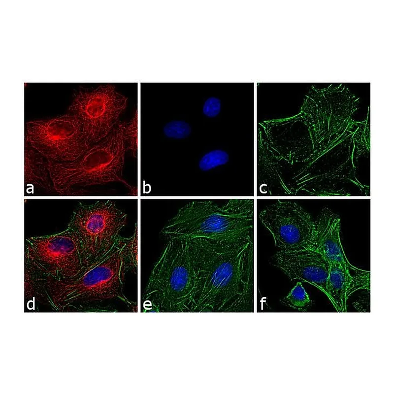 Thermo Fisher Scientific Donkey anti-Rat IgG (H+L) Cross-Adsorbed Secondary Antibody, DyLight 594