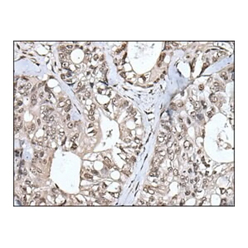 Merck ANTI-TIA1