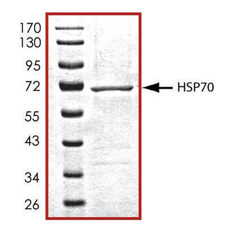 Merck HSP70, His tagged human
