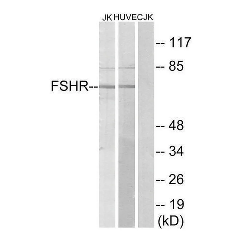 Merck Anti-FSHR antibody produced in rabbit