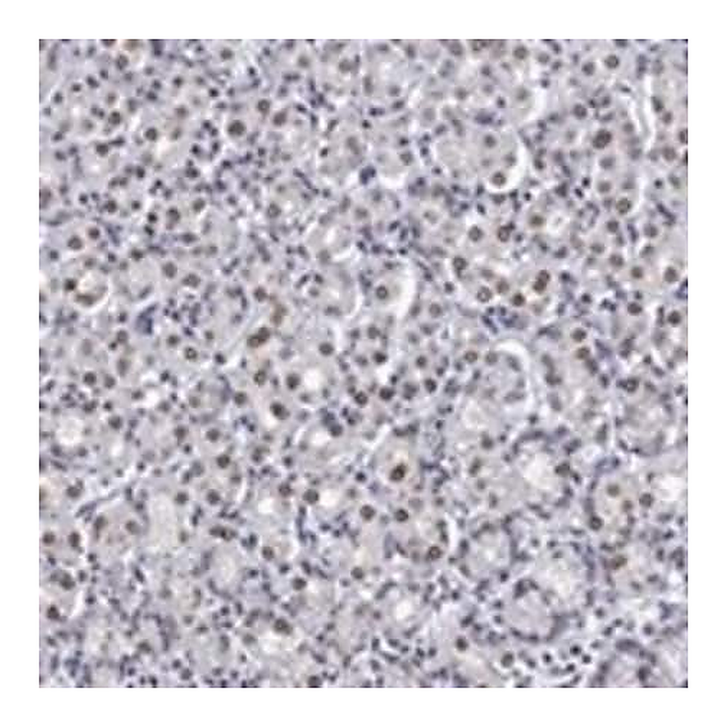 Merck Anti-TOR1AIP1 antibody produced in rabbit