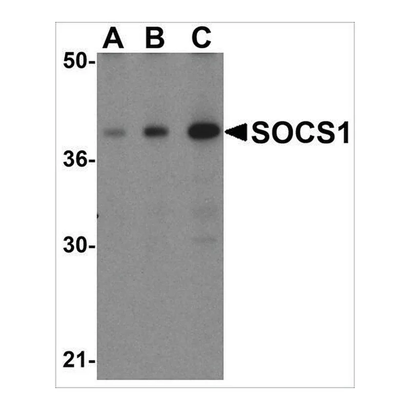 Merck Anti-SOCS1 (ab1) antibody produced in rabbit