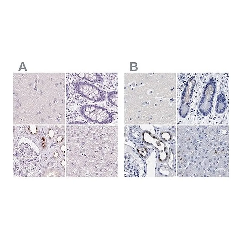 Merck Anti-ATP6V0A4 antibody produced in rabbit