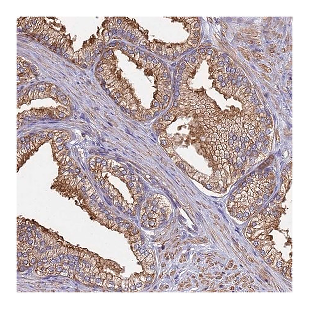 Merck Anti-CBWD1 antibody produced in rabbit
