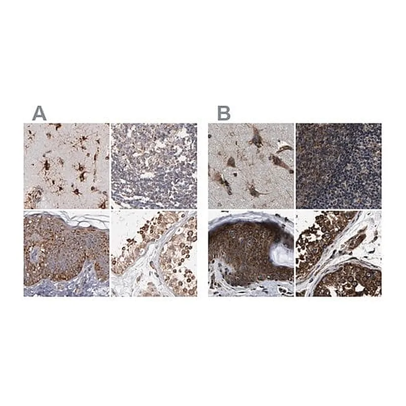 Merck Anti-KTN1 antibody produced in rabbit