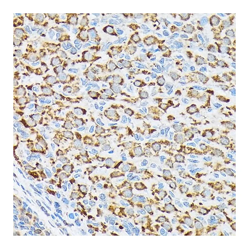 Merck Anti-p70 S6 Kinase 2 antibody produced in rabbit