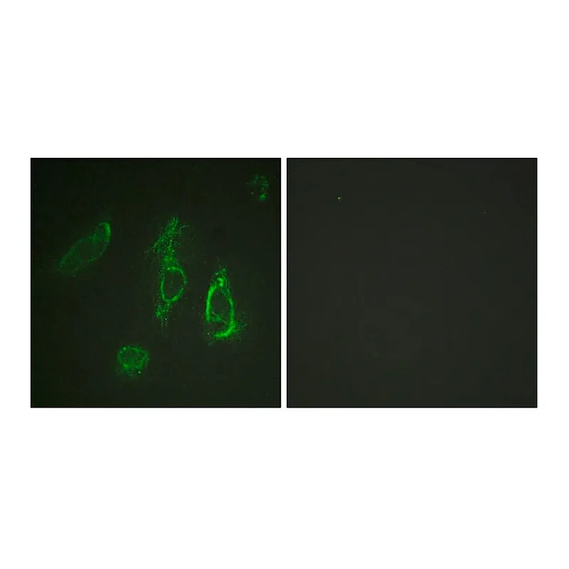 Merck Anti-EPO-R antibody produced in rabbit