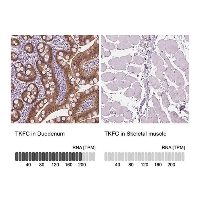 Merck Anti-TKFC antibody produced in rabbit