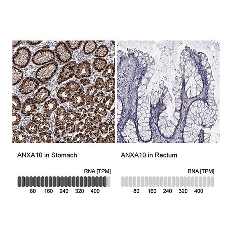Merck Anti-ANXA10 antibody produced in rabbit