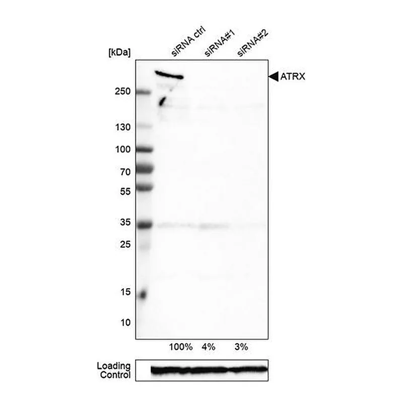 Merck Monoclonal Anti-ATRX antibody produced in mouse