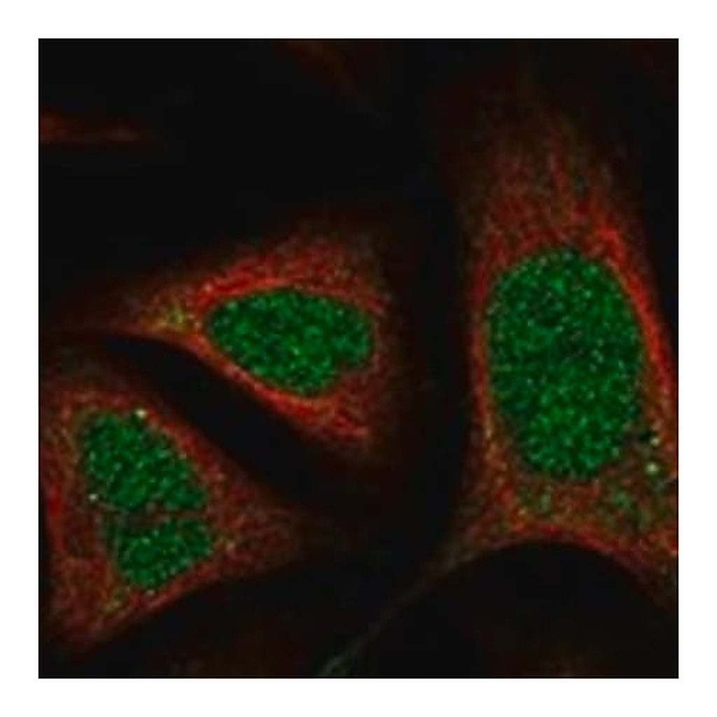Merck Anti-RNASEH1 antibody produced in rabbit