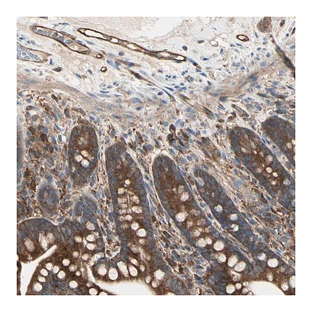 Merck Anti-IGSF9B antibody produced in rabbit
