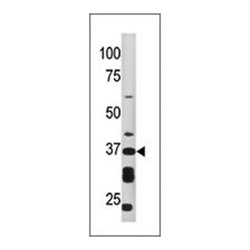 Merck ANTI-ART1 (N-TERM)