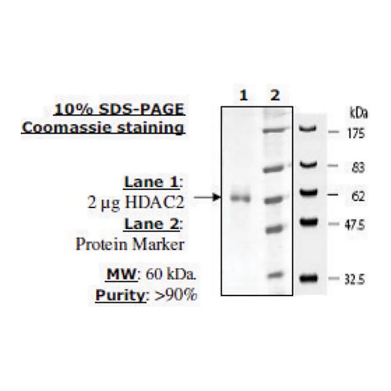 Merck HDAC 2 His tag human