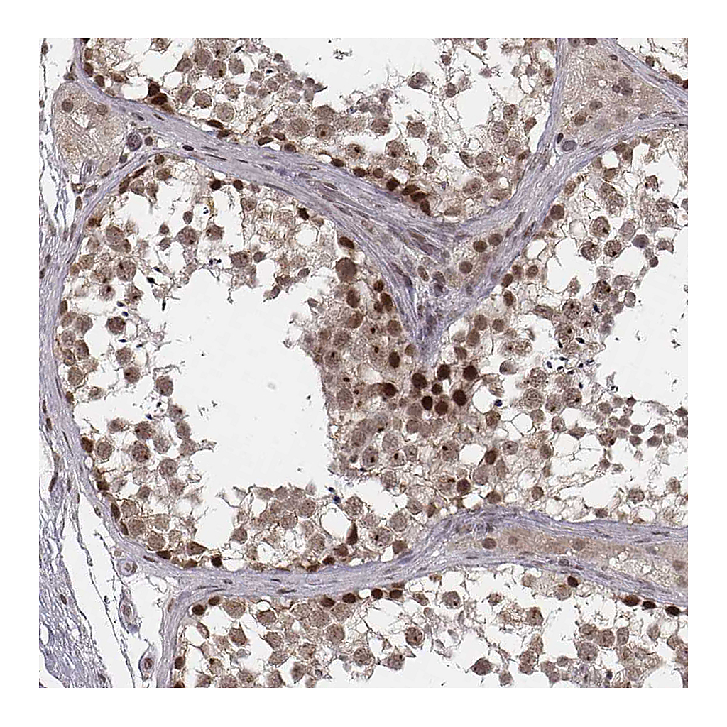 Atlas Antibodies Anti-HMGA2 Antibody