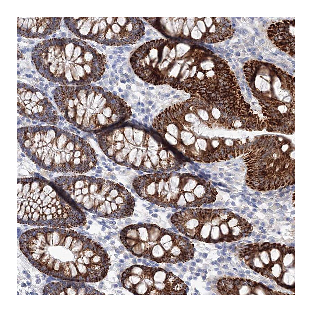 Atlas Antibodies Anti-HMGCS1 Antibody