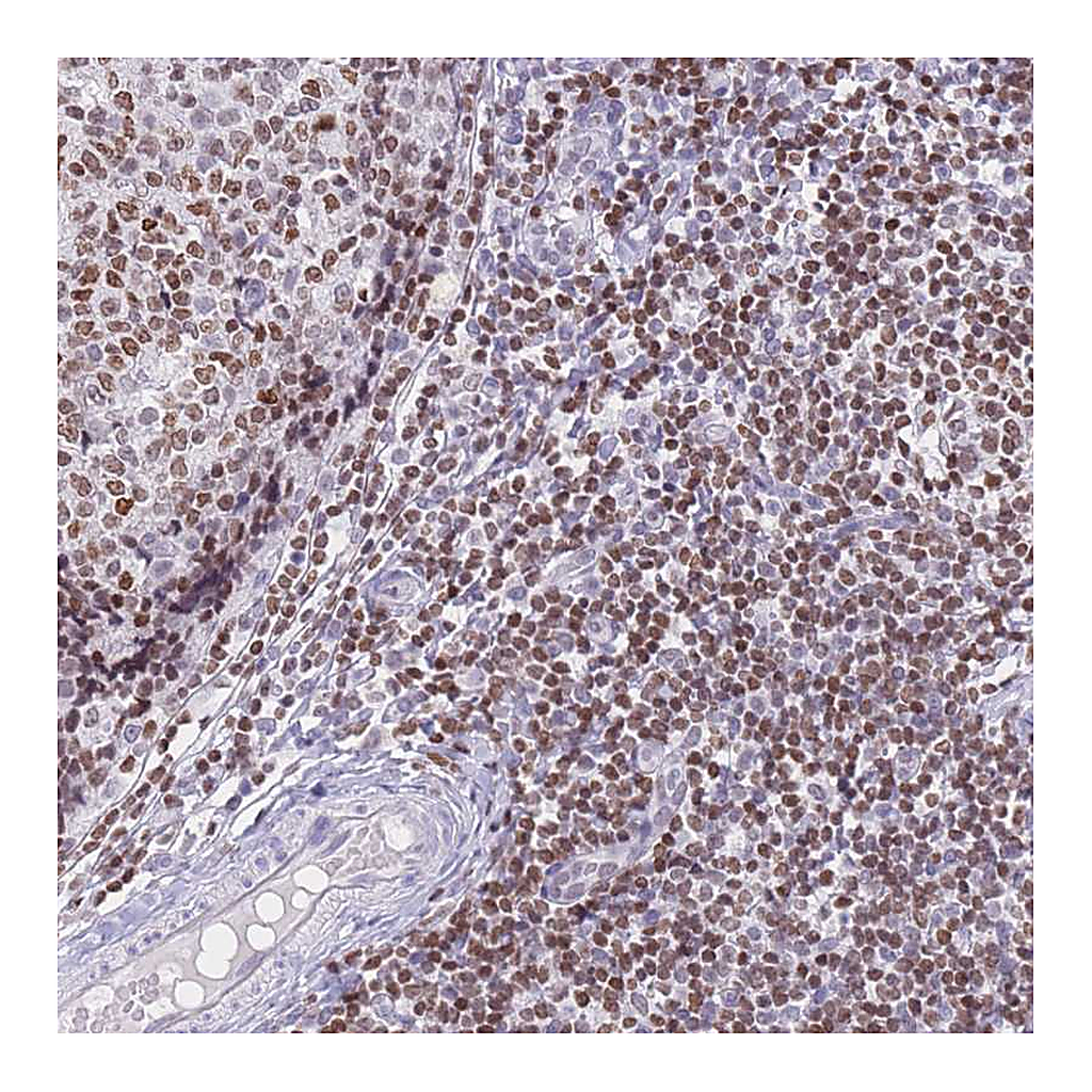 Atlas Antibodies Anti-HMGN1 Antibody