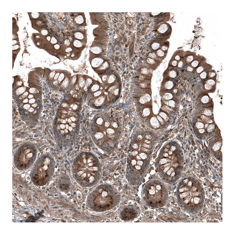 Atlas Antibodies Anti-HMGCR Antibody