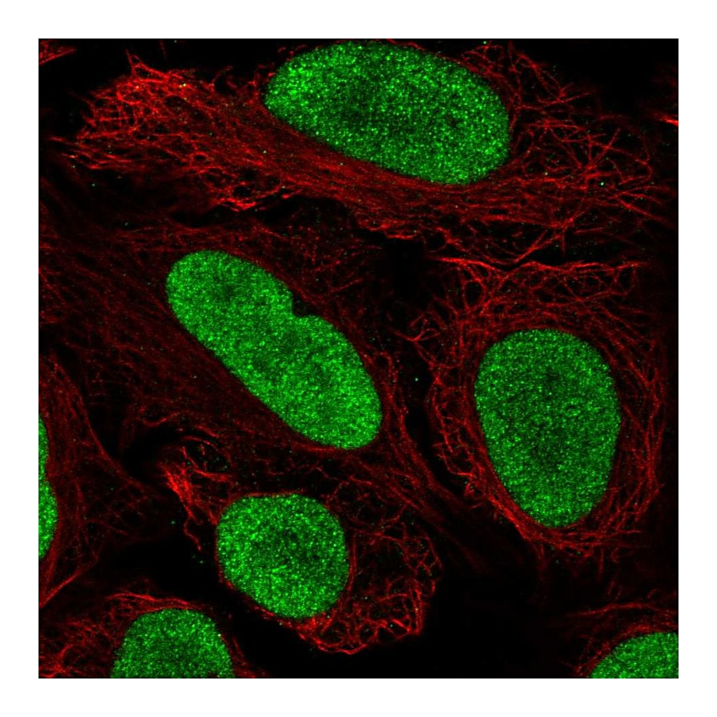 Atlas Antibodies Anti-HMGN2 Antibody