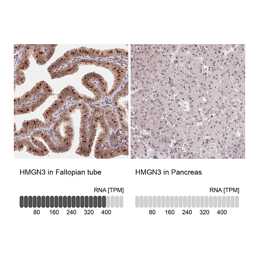 Atlas Antibodies Anti-HMGN3 Antibody