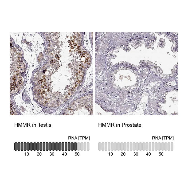 Atlas Antibodies Anti-HMMR Antibody
